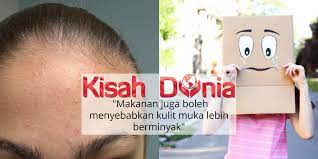 Cara menghilangkan jerawat pasir sebenarnya cukup mudah. Tips Berkesan Hilangkan Jerawat Pasir Yang Terakhir Tu Ramai Malas Buat Kisah Dunia