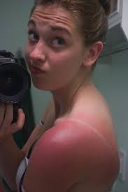 Battle Scars June 6th, 2011 I might have won the fishing …