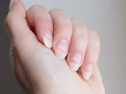 This symptom of covid nails is shown earlier than other fingernail complaints. Coroanvirus Symptoms Covid Nails Could Be A Sign That You Have Had Covid Here S How To Identify It