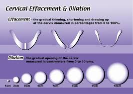 Key Differences Between Dilation Effacement Station Dilation And Effacement Cervical Dilation Chart Cervix Dilation Chart