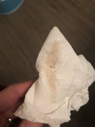 10dpo Brown Spotting Implantation Pic Trying For A Baby Babycenter Canada