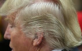 Other prospective and retrospective studies report that finasteride may improve hair loss in women with female pattern hair loss or frontal fibrosing alopecia. Finasteride Does Donald Trump S Favourite Hair Loss Treatment Really Work