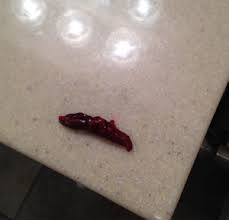 Maybe you would like to learn more about one of these? Miscarriage At 6 Weeks Big Clot Came Out Warning Graphic Picture Grief Loss Forums What To Expect