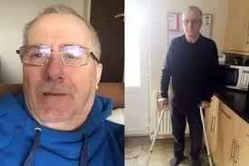 Notts man's plea for surgery to end pain from life-long spinal defect