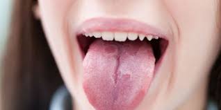 Maybe you would like to learn more about one of these? Lingua A Fragola Tutte Le Possibili Cause Roba Da Donne