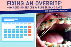 First, tooth crookedness is resolved. How Long Do Braces And Rubber Band Take To Fix Overbite Orthodontic Braces Care