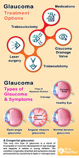 This damage is often caused by an abnormally high pressure in your eye. Pin On Glaucoma