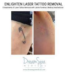 Empire tattoo is boston's best custom tattoo shop with award winning artists capable of executing all styles of tattooing. Laser Tattoo Removal In Boston Ma Boston Laser Technicians Canton Brookline Ma