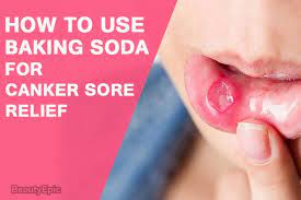 How Can Baking Soda Help Relieve Canker Sores Canker Sore Cankers Canker Sore Remedy