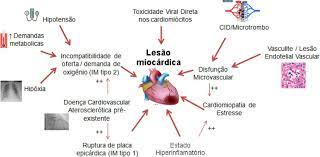 #miocardite olha só, o meio campo do corinthians paranaense, willliam, jah teve miocardite. Doenca De Coronavirus 19 E O Miocardio