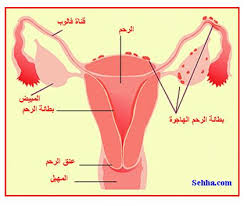 هل لديك مقترحات لتحسين تجربتك أكثر؟ بريدك الإلكتروني *. Ø§Ø³Ø¨Ø§Ø¨ ÙˆØ§Ø¹Ø±Ø§Ø¶ ÙˆØ¹Ù„Ø§Ø¬ Ø¯Ø§Ø¡ Ø¨Ø·Ø§Ù†Ø© Ø§Ù„Ø±Ø­Ù… Ø§Ù„Ù…Ù‡Ø§Ø¬Ø±Ø© Ø¹Ø§Ù„Ù… Ø­ÙˆØ§Ø¡