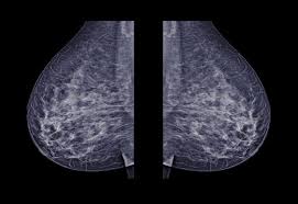 A 3d mammogram is used to look for breast cancer in people who have no signs or symptoms. What You Need To Know Before Choosing A 2d Or 3d Mammogram