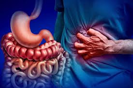 Image result for Appendicitis