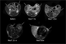 Ct scans do not have these problems; Use Of Fcc Nmrd Relaxometry For Early Detection And Characterization Of Ex Vivo Murine Breast Cancer Scientific Reports