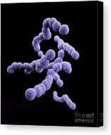 Image result for Group B Streptococcus