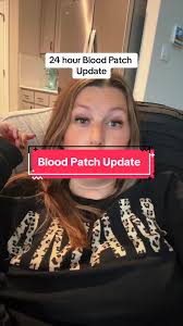 Blood Patch Update: Relief From Headache, But Now Back Pain
