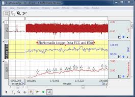 Eda Electrodermal Activity Neuromarketing And