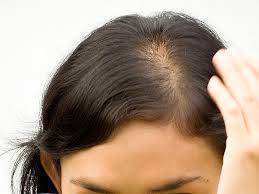 Depending on the type of chemo drug you use, hair loss may also affect your eyelashes, eyebrows, facial hair, armpits, arms,. After Great Pain A Cold Cap For Chemo Hair Loss Came