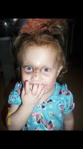 This little sweet girl has been a fighter since day one. Next week we find  out if Karrington needs another procedure for her heart. Please continue to  keep this sweet angel in