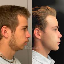 Dr. David Alfi DDS MD FACS (@dr.davidalfi) • Instagram photos and videos