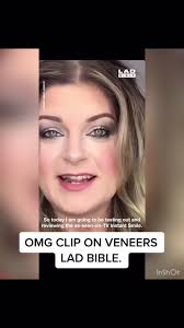 Transform Your Smile with Clip On Veneers