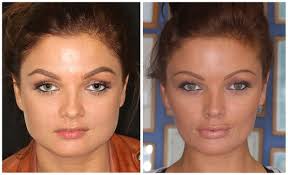 How to get skinnier cheeks. Facial Slimming Drbk Cosmetic Dentist Aesthetics Clinic In Reading