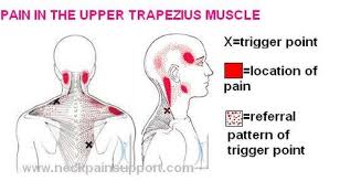 Pin On Massage Trigger Points