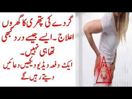 59 Gurday Ki Pathri Ka Ilaj Get Rid Of Kidney Stone Treatments Youtube In 2020 Kidney Stones Kidney Treatment