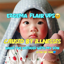 Identifying RA Triggers in Hands and Feet: My Personal Experience