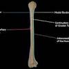 Proximal radius (head, neck and tuberosity). 1