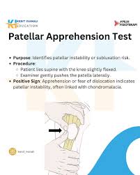 Image result for Patella Mobility Test