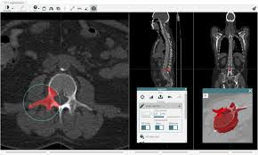 Located the structure located the structure proximal & hardandsmooth hadholes distal articularcartilage able topenetrate epiphysis spongybone spongy bone longandhard boney hard compactbone structures in diaphysis filled with bone nutrient art 11. Recomia A Cloud Based Platform For Artificial Intelligence Research In Nuclear Medicine And Radiology Ejnmmi Physics Full Text