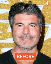 What did Kody do to his face?