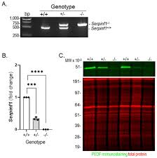 PEDF Deletion Induces Senescence and Defects in Phagocytosis in the RPE