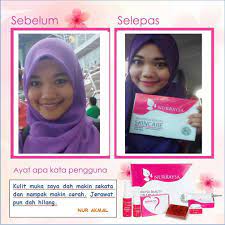 Apa bener alkohol punya efek seburuk itu ke kulit? Nurraysa Beauty Bahaya Hq The Junni Original Shah Alam Facebook