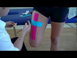 How To Apply Kinesiology Taping For A Strain Of The Rectus Femoris Quadricep Muscle Strain Youtube Kinesiology Taping Muscle Strain Kinesio Taping