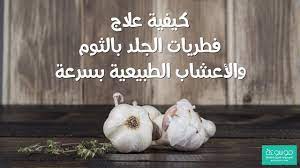 كيفية علاج فطريات الجلد بالثوم والطب البديل خلطات سحرية مجربة youtube