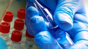 Tak Hanya Bumn Emiten Ini Siap Rilis Avimac Obat Covid 19