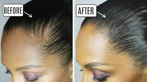 How To Hide A Bald Spot Discocurlstv Youtube