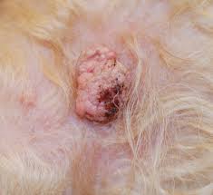 Learn more about targeted therapy, surgery, and chemotherapy. Image Gallery Common Skin Masses Clinician S Brief