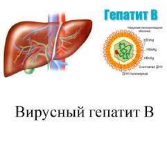 Lechenie Gepatita B U Vzroslyh I Detej Lechenie Ostrogo I Hronicheskogo Gepatita B Analiz Krovi Na Gepatit B V Spb