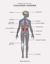 Changes in eyes (bulging, dark circles, droopy eyelids) pain in various locations of the body; 11 Symptoms Of Leukemia In Children