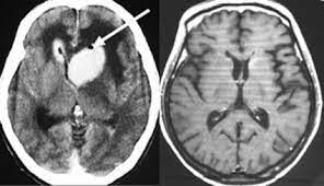 コロナきよつけや みせろー 開脚ー すご おい床そこ代われ 絶対コイツナルシストww 白パンだな 太ももの太さ推定45cm 床になったら直接、パンツをつけ. ä¸­æž¢ç¥žçµŒåŽŸç™ºãƒªãƒ³ãƒ'è…« Pcnsl è„³å¤–ç§'åŒ» æ¾¤æ'è±Šã®ãƒ›ãƒ¼ãƒ ãƒšãƒ¼ã‚¸