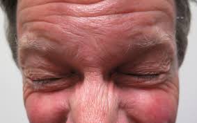 Image result for Blepharis transvaalensis