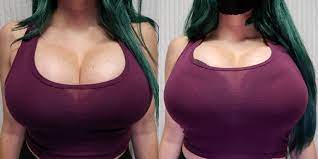 Breast expansion growth