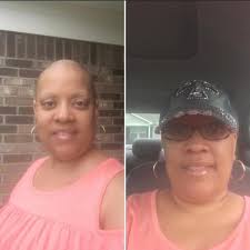 Please read My story..... Part of My testimony... My life is full of  testimonials.... #THEBATTLEISNOTYOURSITSTHELORDS I had back surgery weeks  ago and in the mist of my recovery, I was faced with