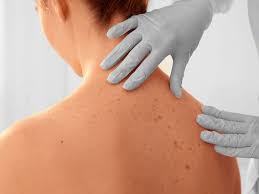 Dermatologie Hautarzt Zurich Https Www Dermatologe Zuerich Ch Klassische Dermatologie Mit Allergologie Diagnostik Ekzeme Hausmittel Ekzem Dermatologie