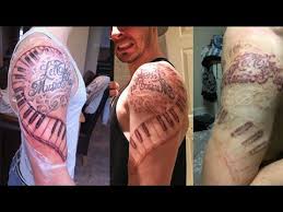 The laser tattoo removal is by far the safest method and it's also the one that gives you the best results. Laser Tattoo Removal London As Seen On Bbc London Pulse Light Clinic London