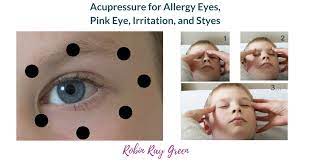 Get Relief Naturally Acupressure For Styes Allergy Eyes Pink Eye And Other Eye Problems Http Www Robinraygreen Com Acu Allergy Eyes Pink Eyes Acupressure
