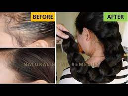 Super Fast Hair Growth Stop Hair Fall Eliminate Baldness Natural Home Remedies Channel You Super Fast Hair Growth Hair Growth Faster Fast Hairstyles